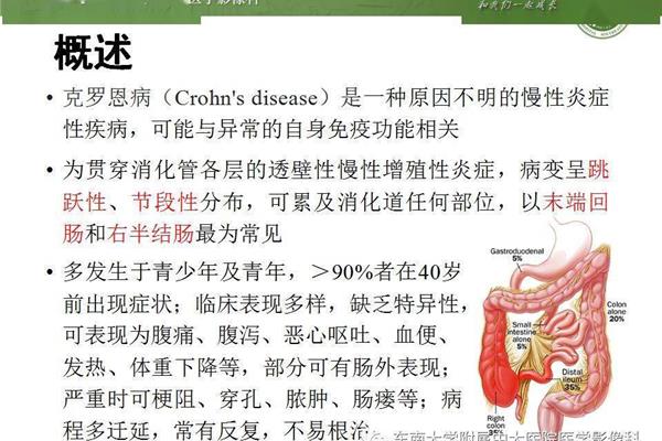 哪些人容易患克罗恩病?克罗恩病的八个早期症状